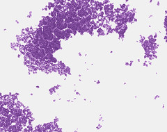 Saccharomyces Cerevisiae Gram Stain