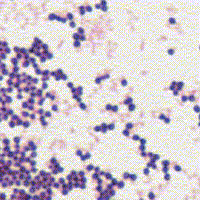 Saccharomyces Cerevisiae Gram Stain