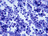 Saccharomyces Cerevisiae Gram Stain