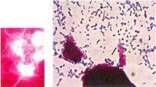 Saccharomyces Cerevisiae Gram Stain Positive Or Negative