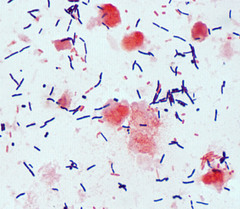 Saccharomyces Cerevisiae Gram Stain Reaction