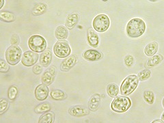 Saccharomyces Cerevisiae Gram Stain Reaction