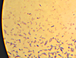 Saccharomyces Cerevisiae Gram Stain Reaction