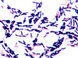 Saccharomyces Cerevisiae Gram Stain Results