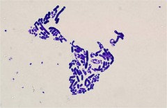 Saccharomyces Cerevisiae Gram Stain Results